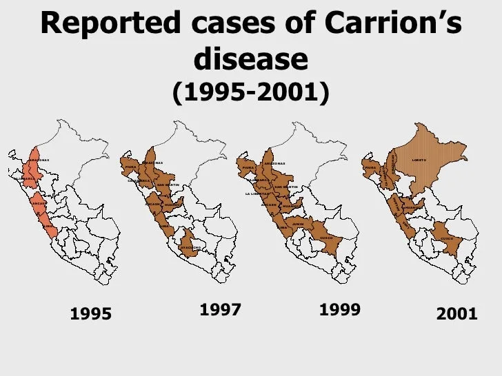 carrion's disease